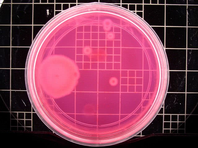 Microbiology is one of the careers biology majors can pursue.